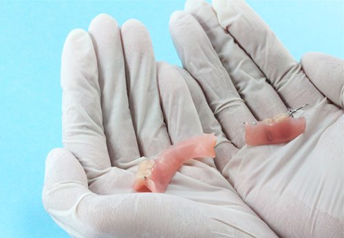 What to Do When You Damage Your Dentures